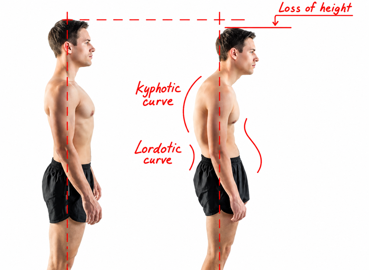 Posture Rebuild Programme.